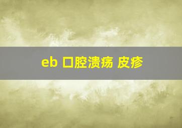 eb 口腔溃疡 皮疹